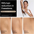 IPL Silk·expert Pro 5, Hårborttagning Hemma, 2 huvuden, PL5210