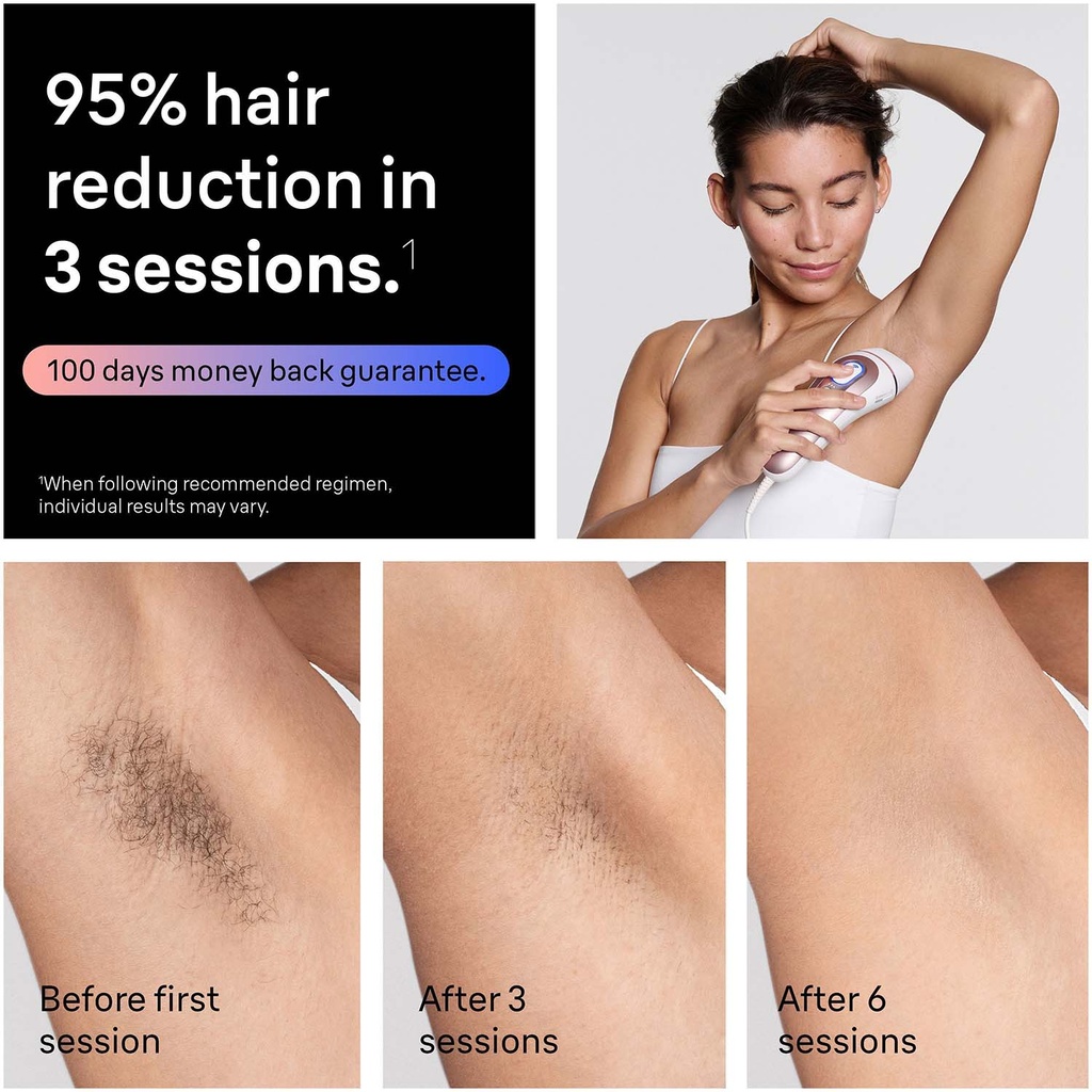 IPL Skin i·expert, Hårborttagning Hemma, Med Gratis App, 2 Smarta Huvuden, PL7211